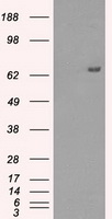 Calreticulin Antibody