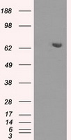 Calreticulin Antibody