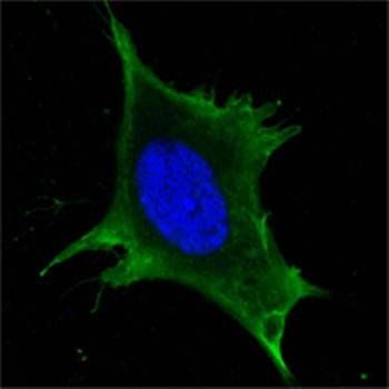 Calreticulin Antibody