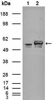 Calreticulin Antibody
