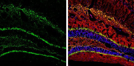 Calretinin antibody