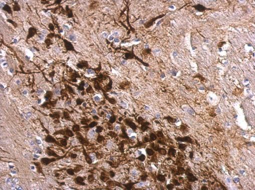 Calretinin antibody
