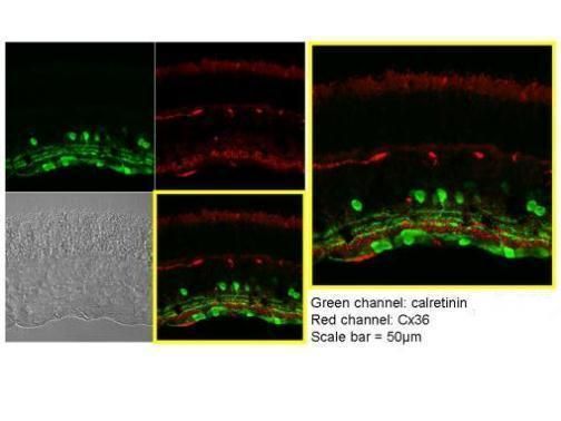 calbindin 2 Antibody