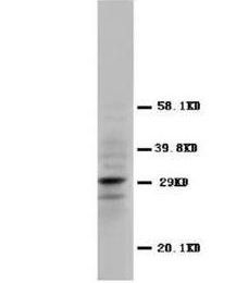 Calretinin/CALB2 Antibody