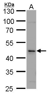 calsequestrin 2 Antibody