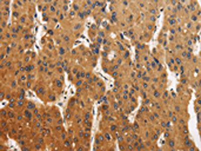 CALU Antibody