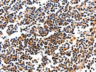 CAMK1 Antibody