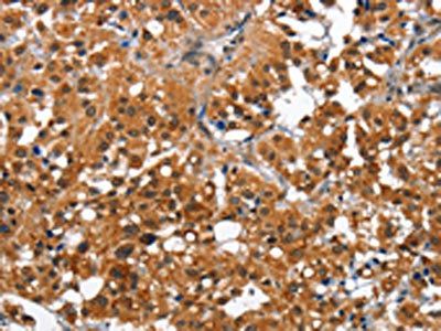 CAMK1D Antibody
