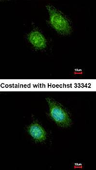 CAMK1D antibody