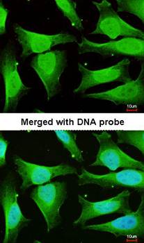 CAMK1D antibody