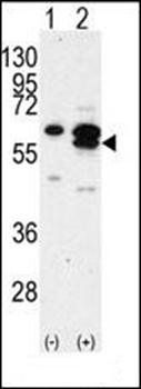 CAMK1G antibody