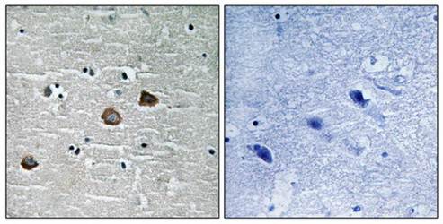 CaMK2-β/γ/δ (Phospho-Thr287) Antibody
