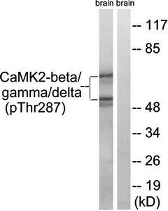 CaMK2-beta/gamma/delta (phospho-Thr287) antibody