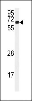 CAMK2A antibody