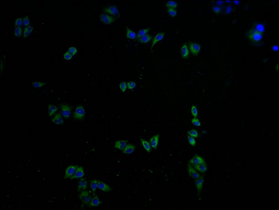 CAMK2A Antibody