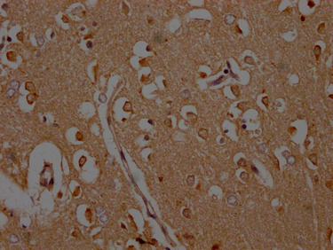 CAMK2A Antibody