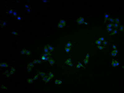 CAMK2A Antibody
