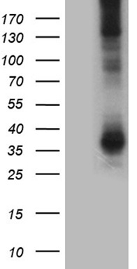 CAMK2B Antibody