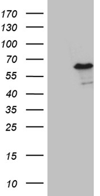 CAMK2B Antibody