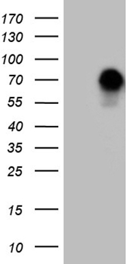 CAMK2B Antibody