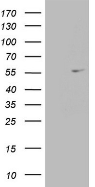 CAMK2B Antibody