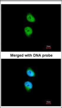 calcium/calmodulin dependent protein kinase ID Antibody
