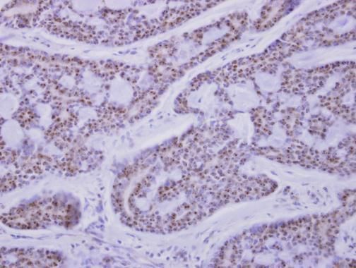 calcium/calmodulin dependent protein kinase ID Antibody