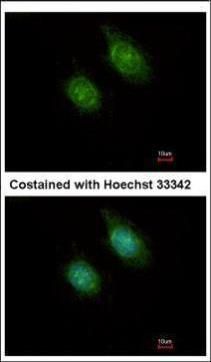 CaMKI delta Rabbit Polyclonal Antibody
