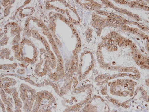 CaMKI delta Rabbit Polyclonal Antibody