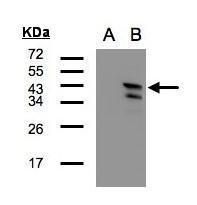 CaMKI delta Rabbit Polyclonal Antibody