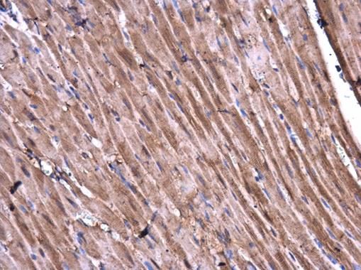 CaMKII delta antibody
