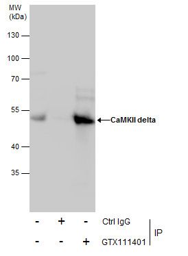 CaMKII delta antibody