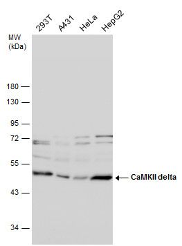 CaMKII delta antibody