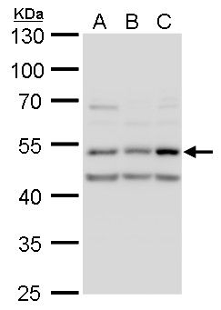 CaMKII delta antibody