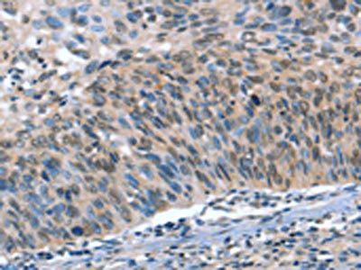 CAMTA1 antibody