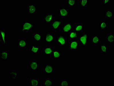 CAND1 Antibody