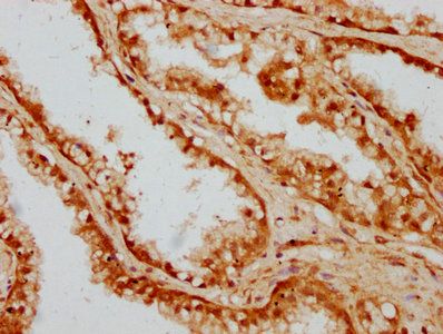 CAND1 Antibody