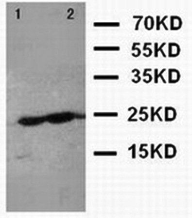 Canstatin Antibody