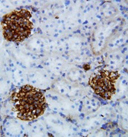Canstatin Antibody