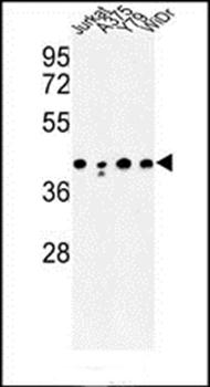 CANT1 antibody