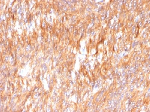 Calnexin (Endoplasmic Reticulum Marker) Antibody