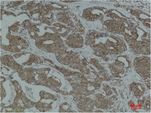 CANX Antibody