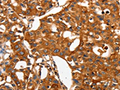 CAP2 Antibody