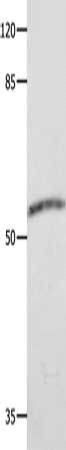 CAP2 Antibody