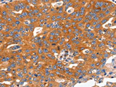 CAP2 Antibody