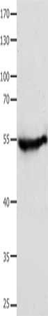 CAP2 antibody