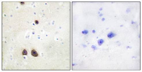 Caper Antibody