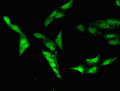 CAPN14 Antibody