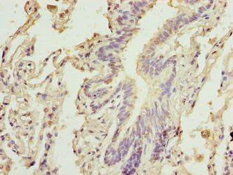 CAPN6 Antibody