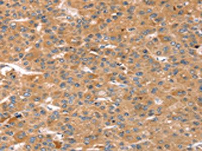 CAPN7 Antibody